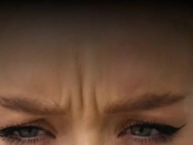 Frown lines (&ldquo;11s&rdquo;) before Botox