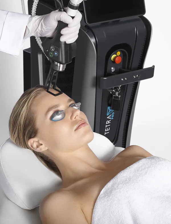 CoolPeel CO2 laser resurfacing