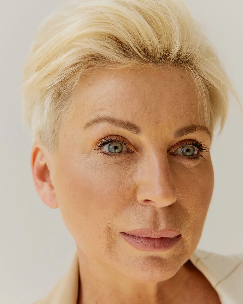 Model face used to show Botox treatment areas (model shown for illustration)