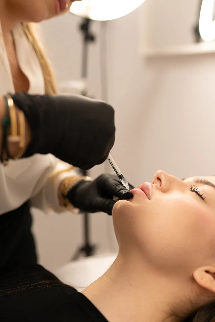 Dr. Parvina performing a precise lip flip injection at the upper lip border