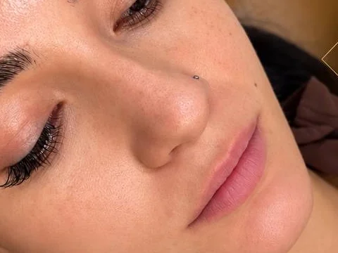 Lips before lip filler