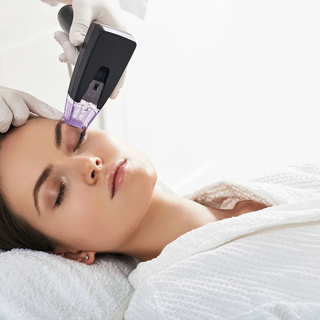 Morpheus8 RF microneedling on the face
