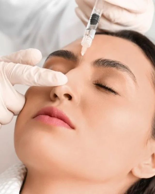 Non-surgical nose job filler injection at the bridge of the nose
