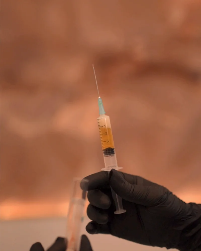 A syringe of golden platelet-rich plasma prepared at Pari Med Spa